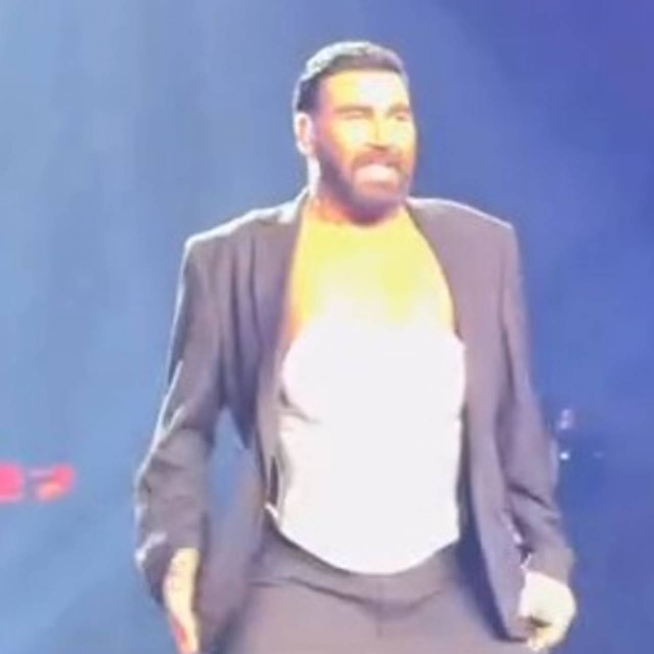 Сменивший имидж исполнитель песни «Мразиш» вышел на сцену в корсете