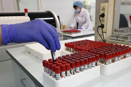 Врачи российской больницы пожаловались на опасный способ перевозки крови пациентов