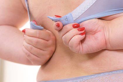 Обладательница самой большой груди в Британии решила от нее избавиться