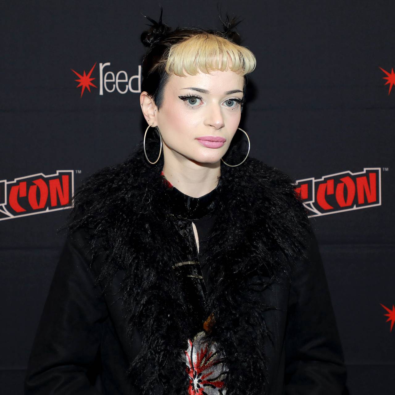 Участнице телешоу ампутировали вторую ногу