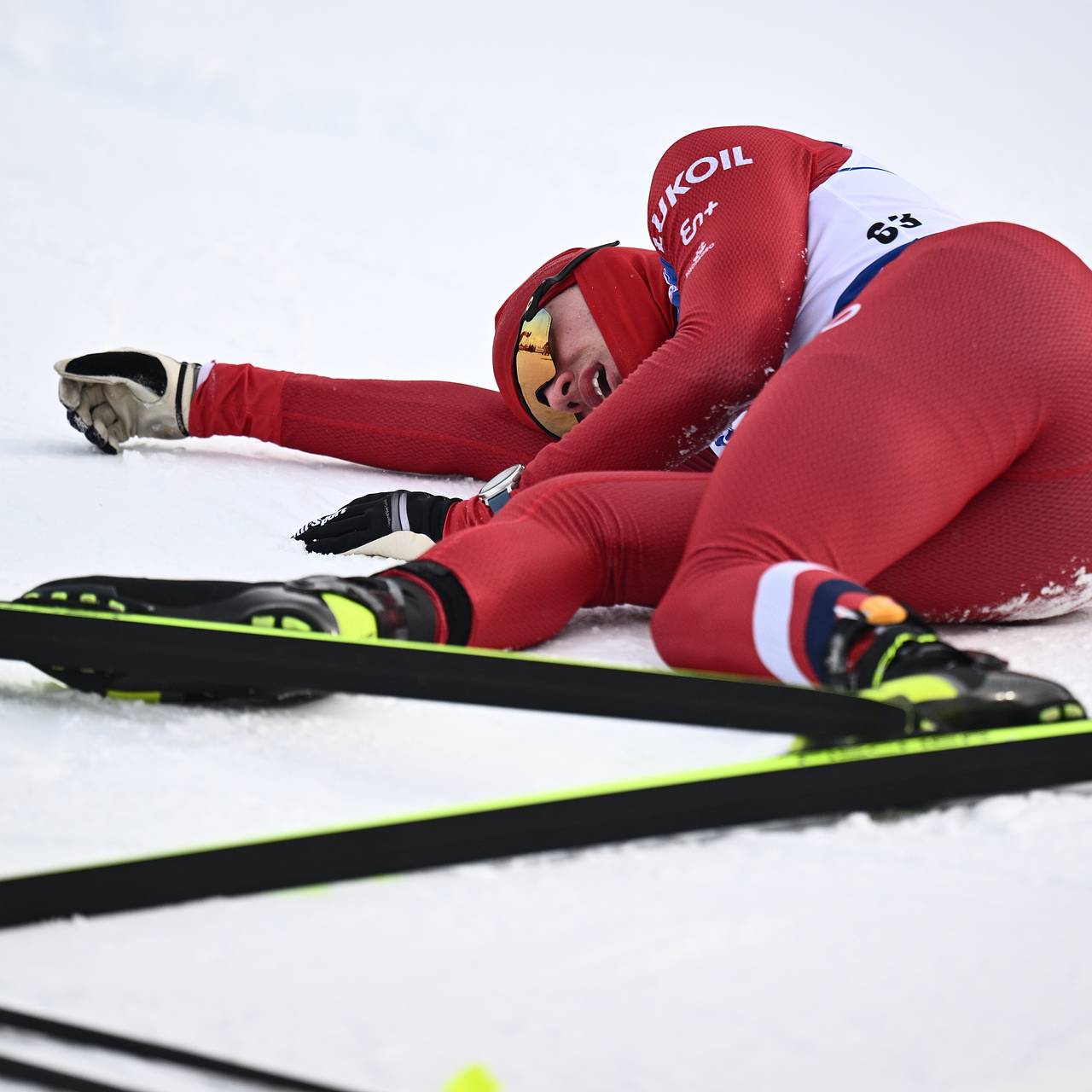 Пострадавший от нападения российский лыжник рассказал о последствиях травмы