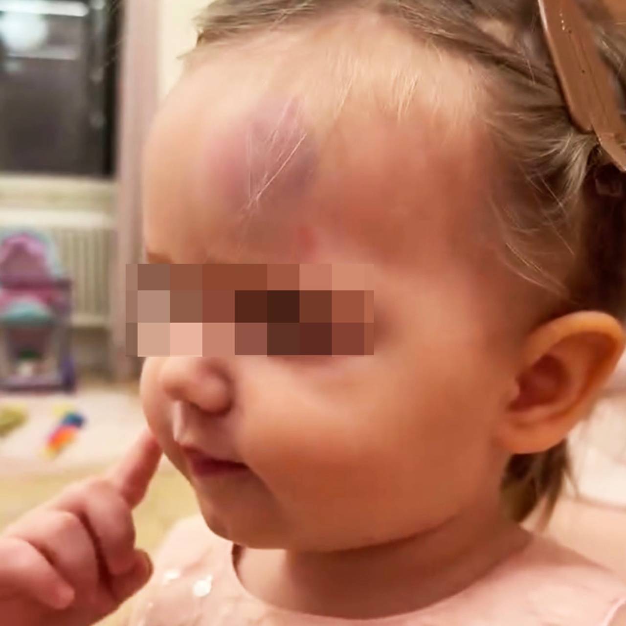 Пятилетняя дочь рэпера ST ударилась головой при падении