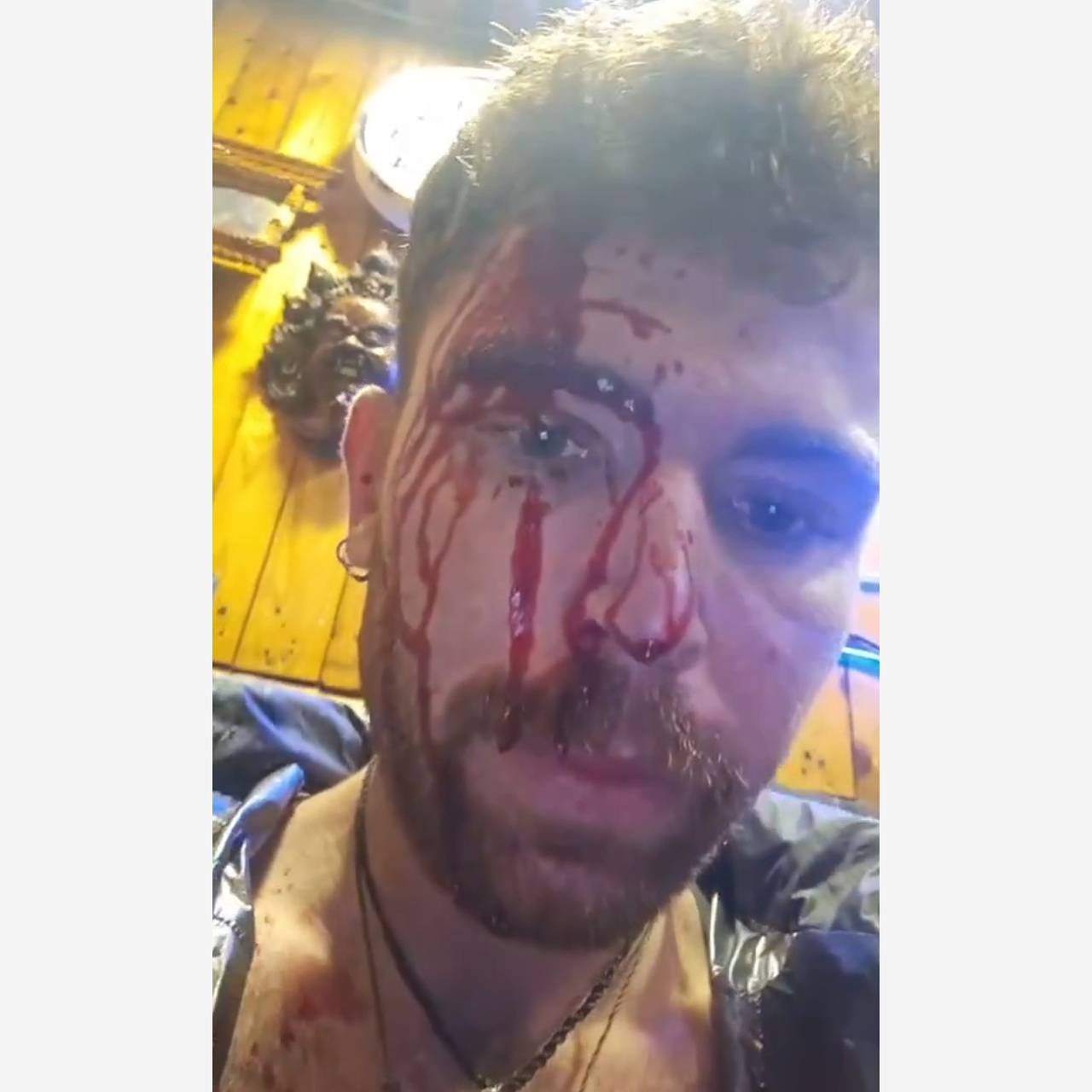 Туриста ударили по голове металлической дубинкой в Непале из-за национальности