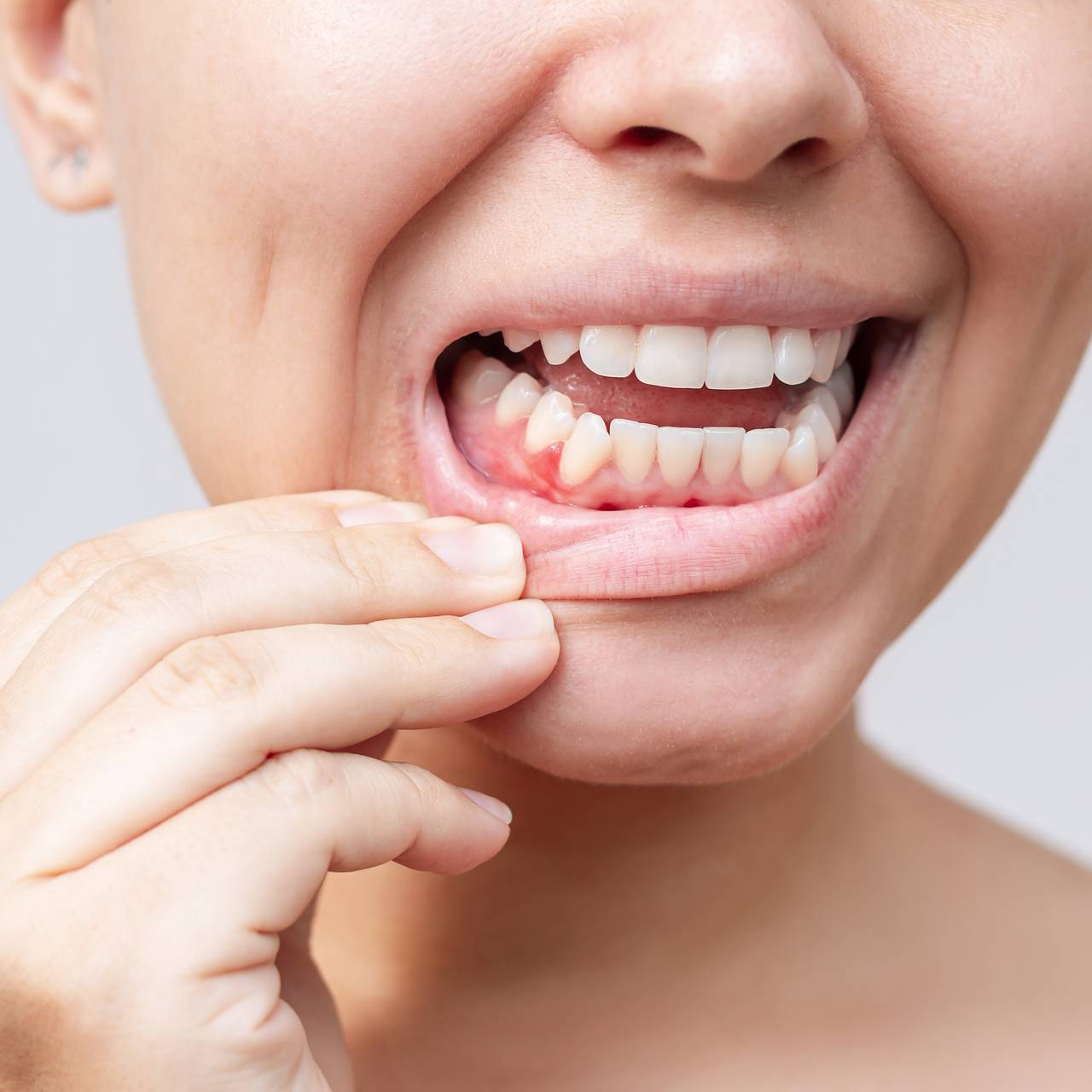 Названа неожиданная связь между здоровьем десен и болезнями сердца