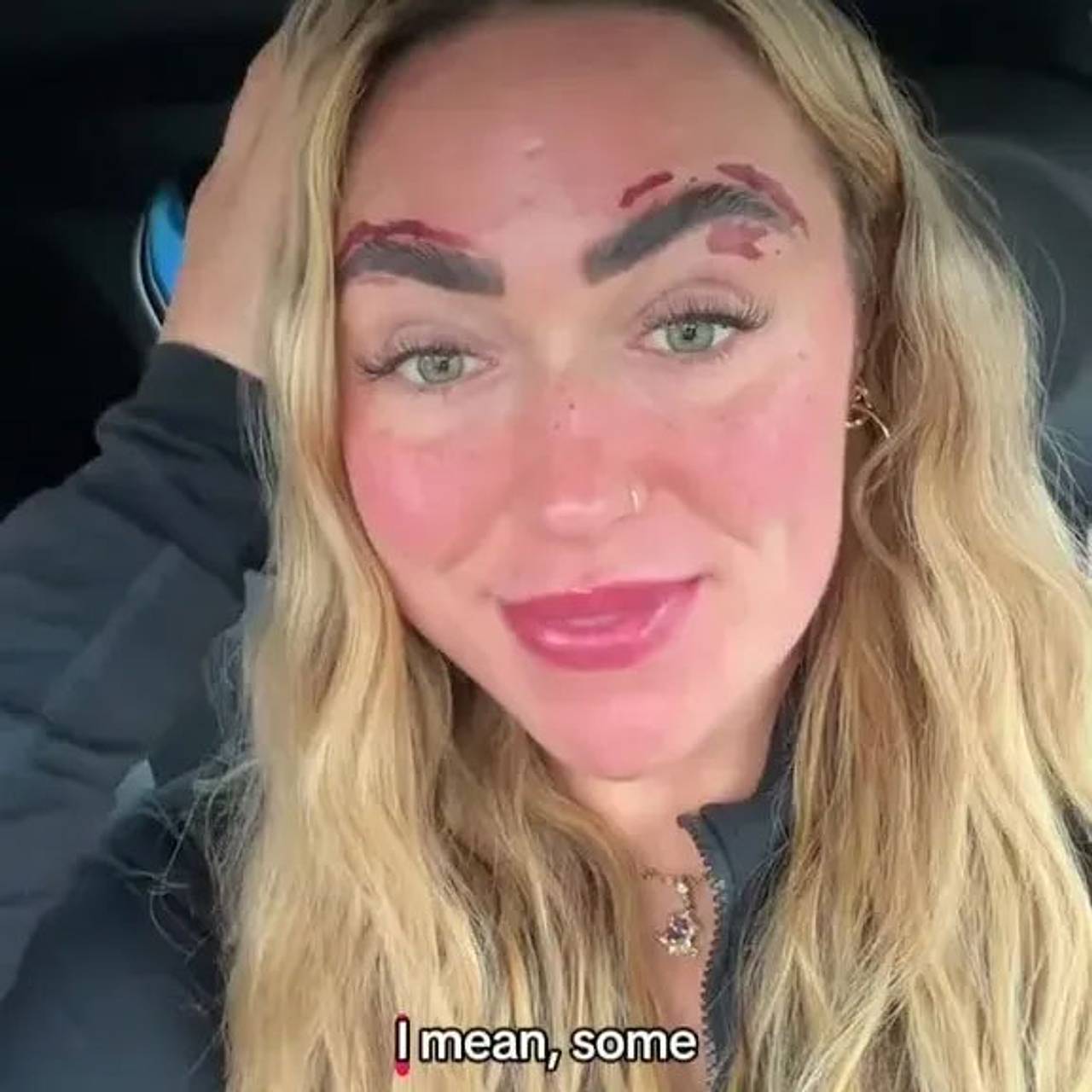 Блогерша не учла одну деталь и осталась с ожогами после коррекции бровей