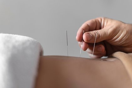 Женщине проткнули легкое во время иглоукалывания