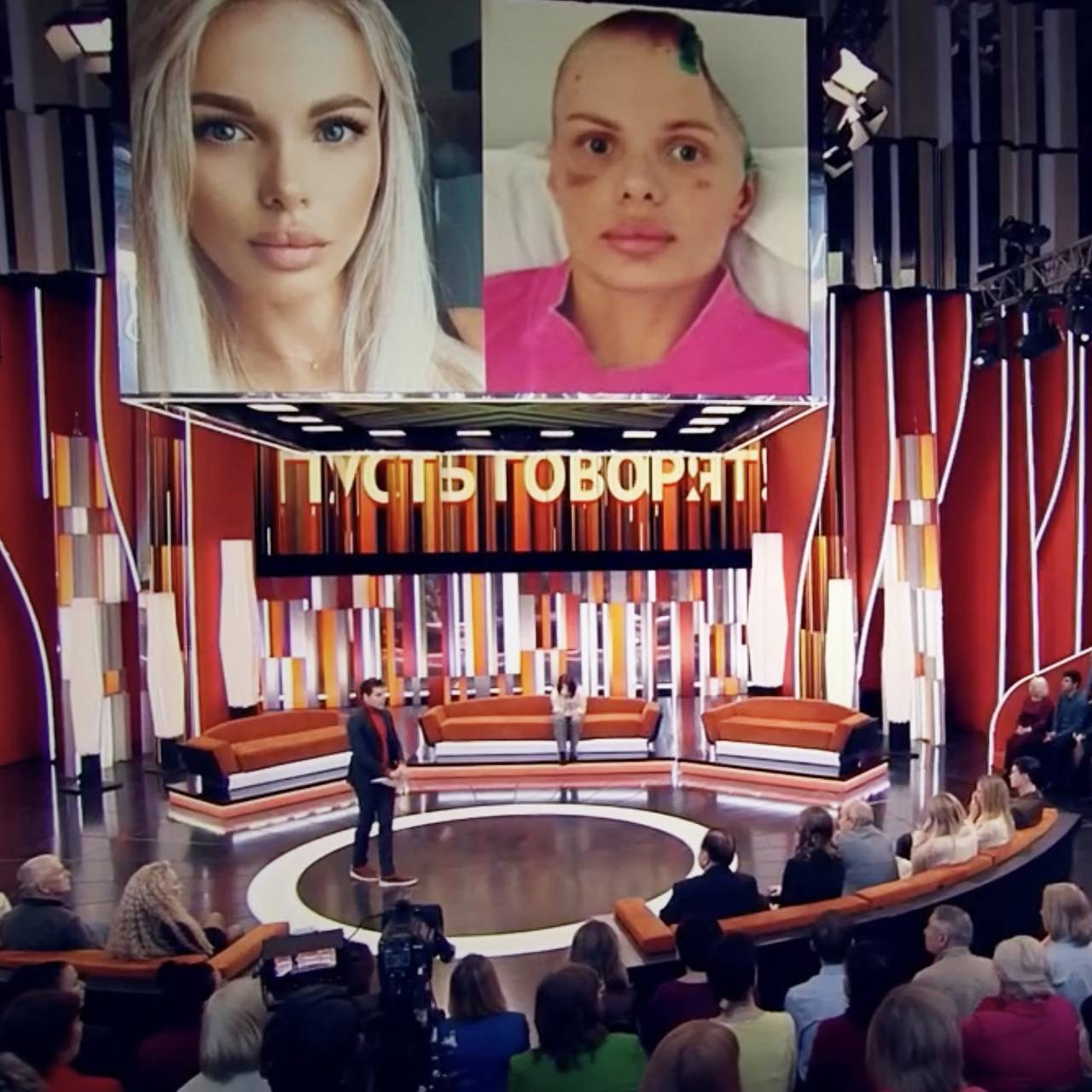 Жестоко избитая в Москве инста-модель лишилась части черепа. Что она рассказала о нападении после выхода из комы?