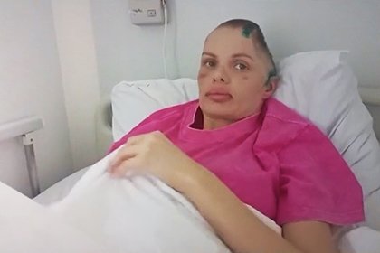 Жестоко избитая в Москве инста-модель лишилась части черепа. Что она рассказала о нападении после выхода из комы?