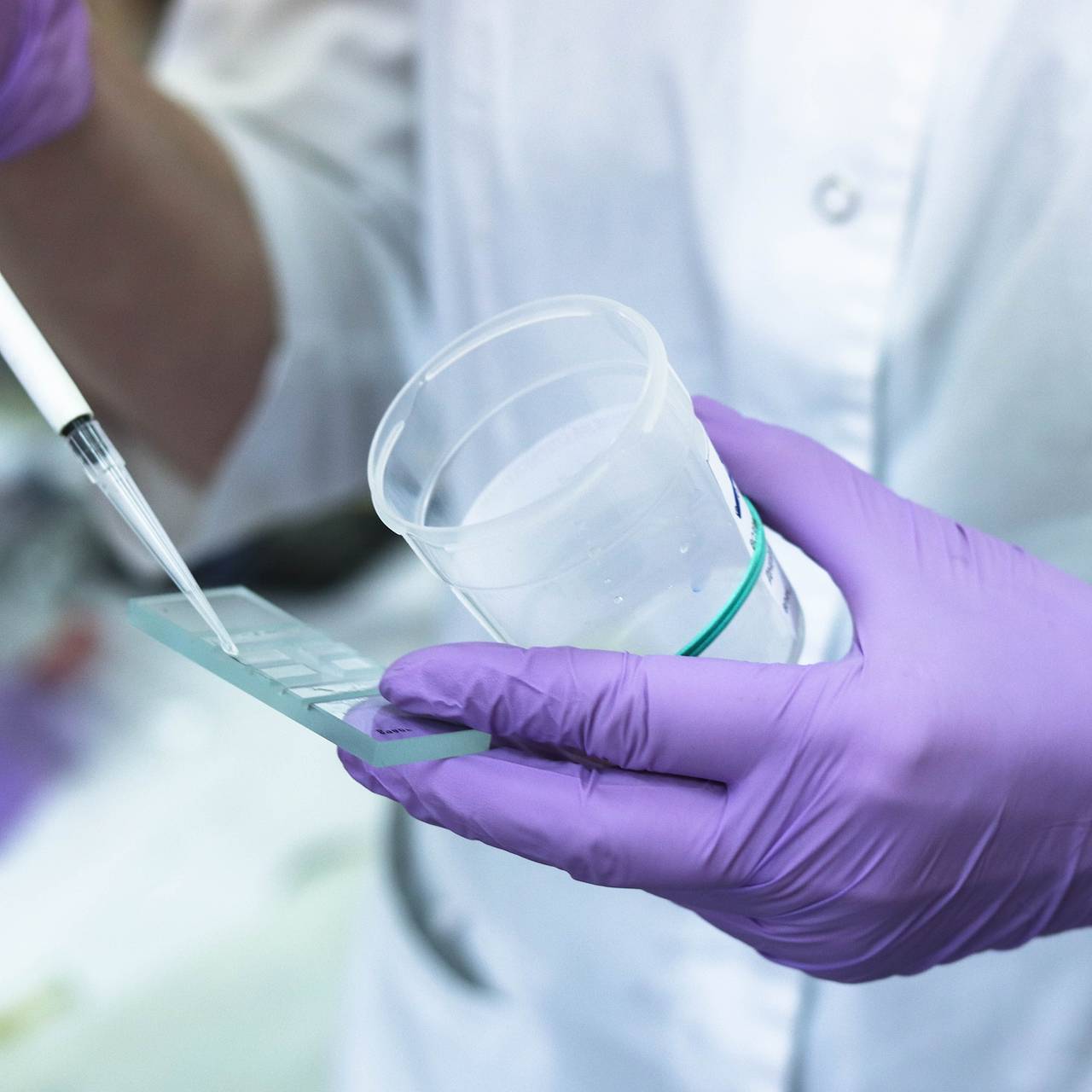 У заболевших в российской гостинице юных регбистов обнаружили норовирус