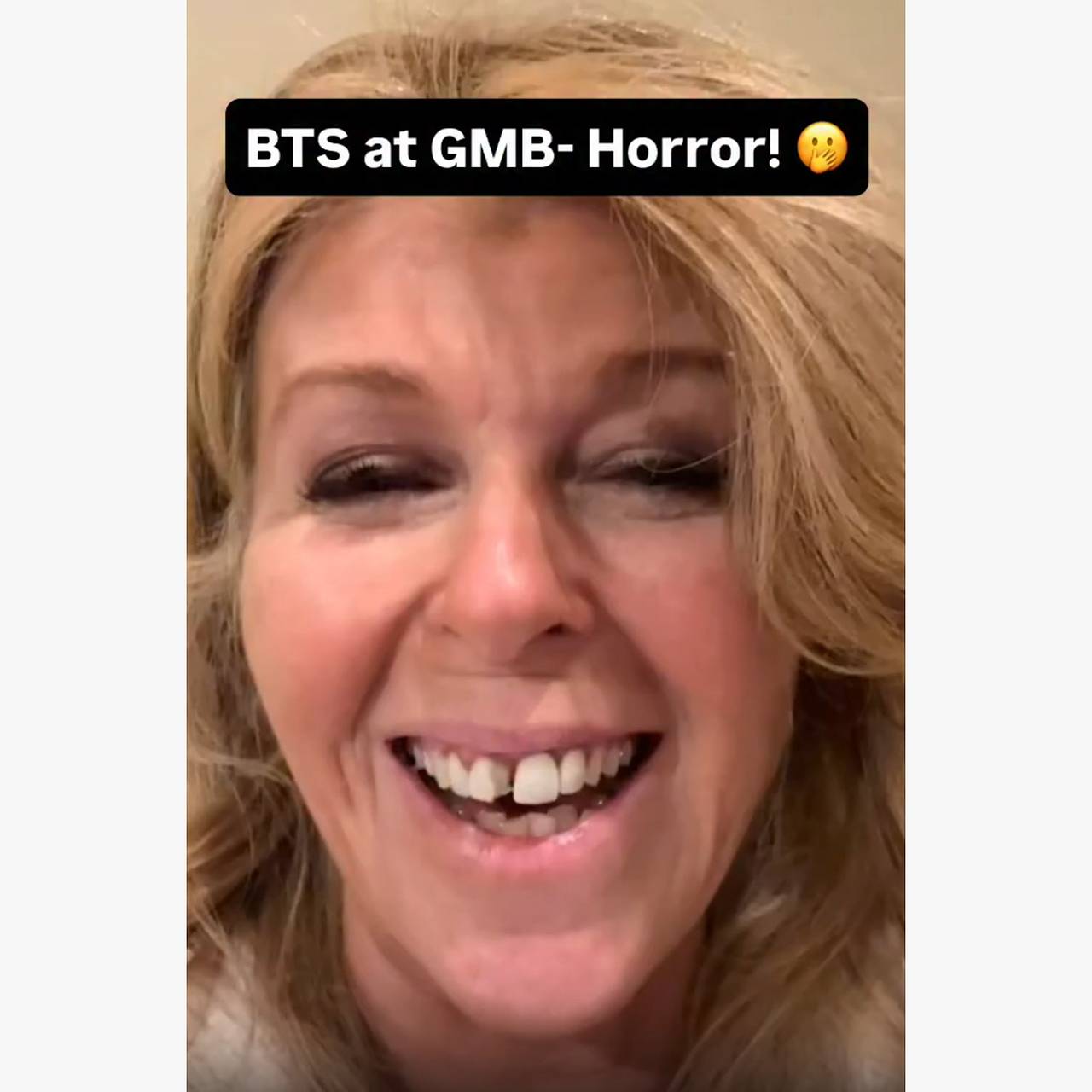 Известная телеведущая показала сломанные зубы после инцидента с такси