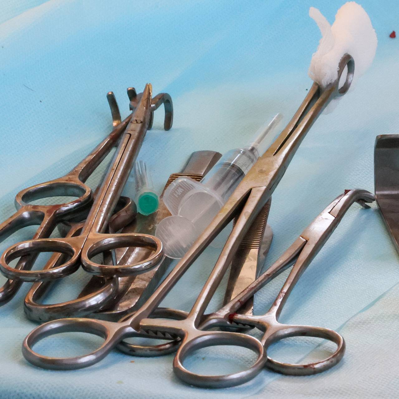 Раскрыто состояние избитого в Екатеринбурге ребенка