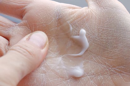 Названы указывающие на серьезные заболевания внешние признаки