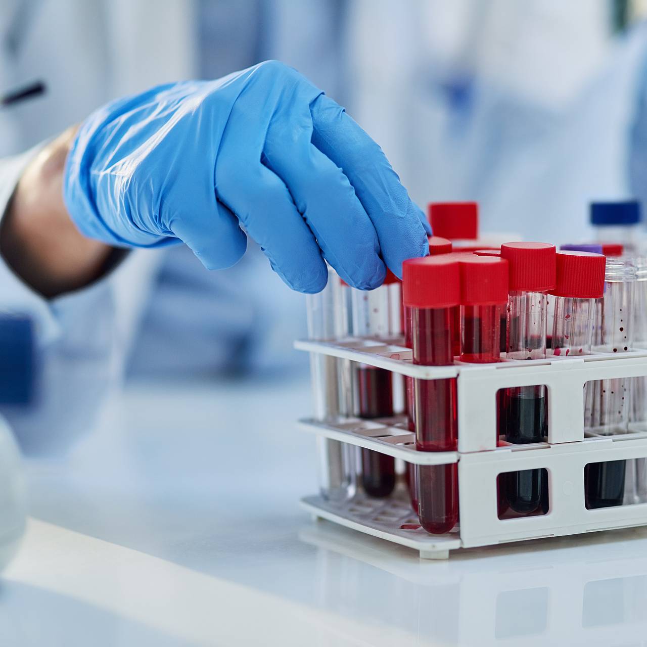 Российский регион едва не оставили без реагентов для диагностики рака из-за логистики