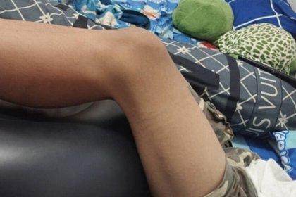 Школьник оказался в больнице после жестокого наказания учителя