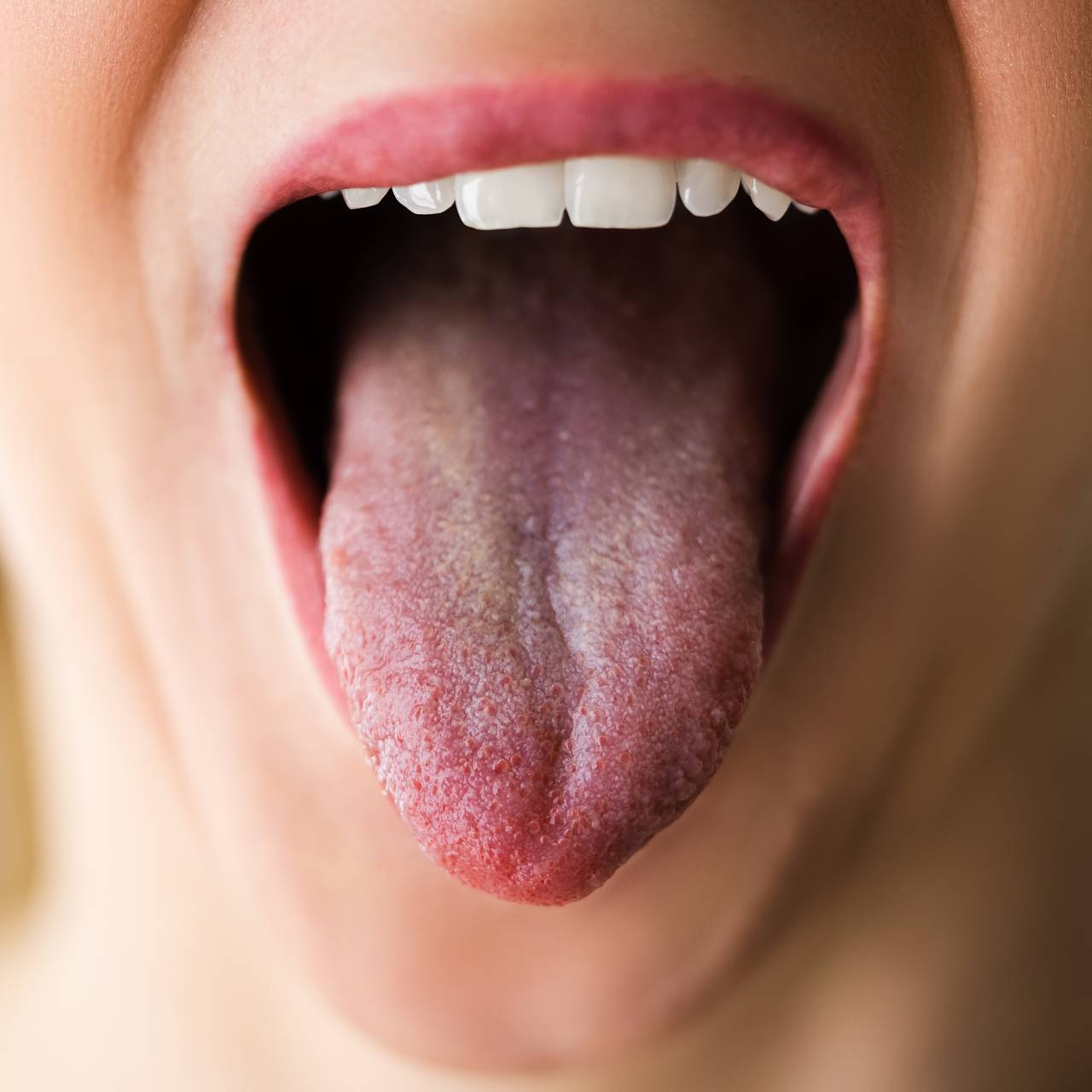 Раскрыт способ определить болезни по состоянию языка