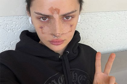 Блогерша Дина Саева показала лицо после пластики