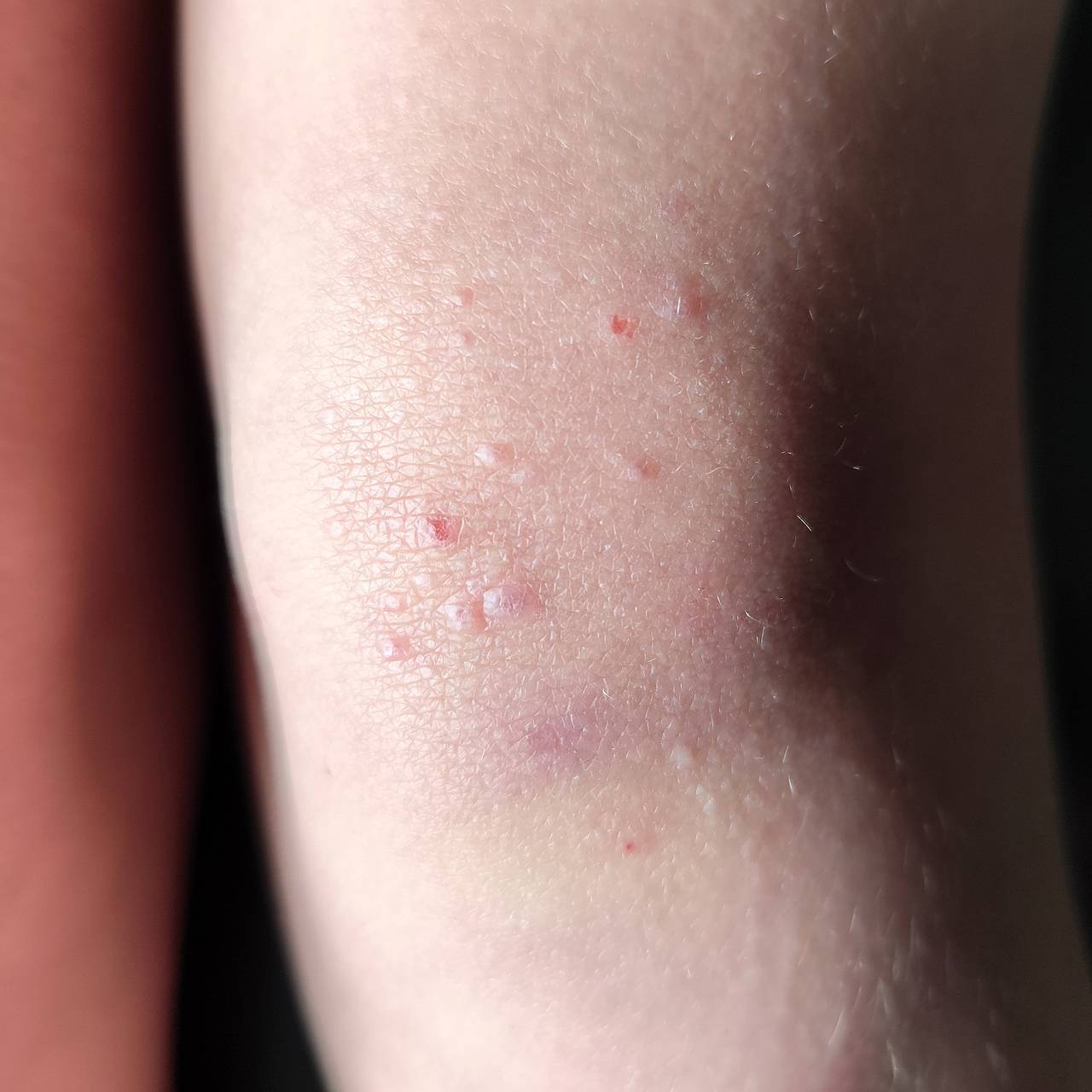 Фото: FotoHelin / Shutterstock / Fotodom