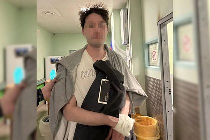 Мужчина съел стекло от разбитого бокала и напал на сотрудников скорой помощи