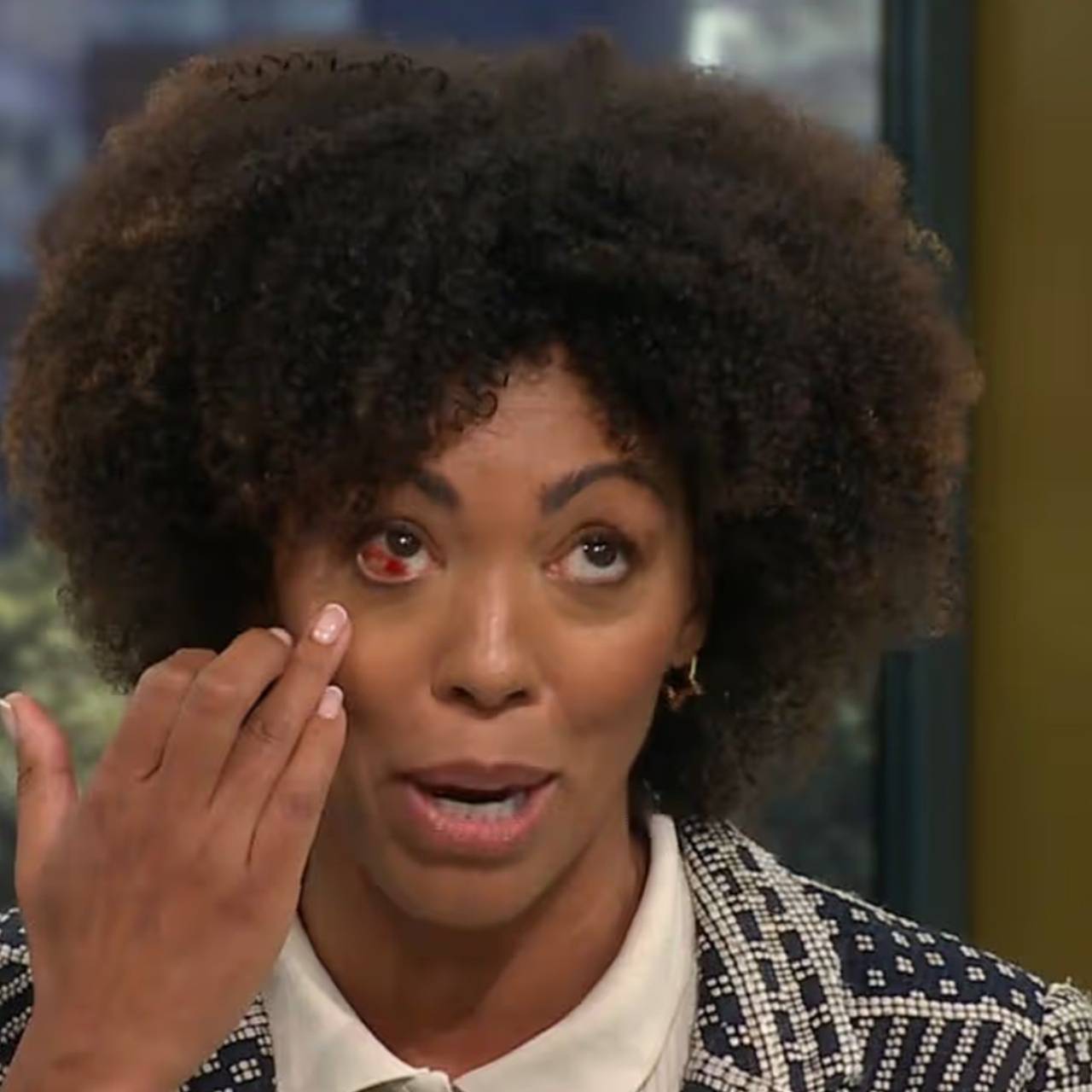 Телеведущий заметил у гостьи шоу пугающий симптом и прервал прямой эфир