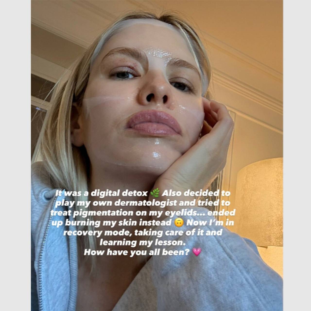 Бывшая возлюбленная российского миллиардера сожгла себе глаз