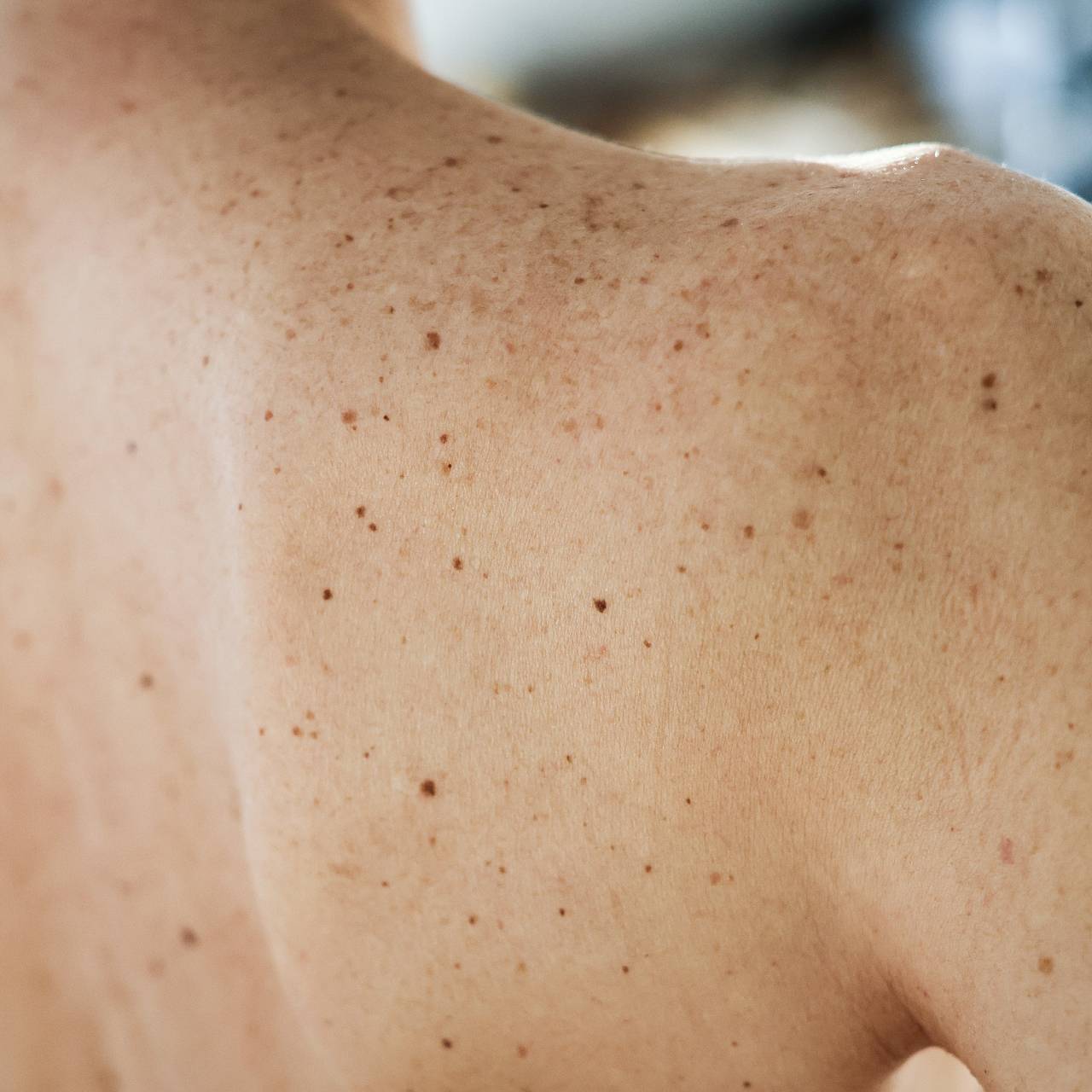 Ученый назвал неочевидный симптом рака