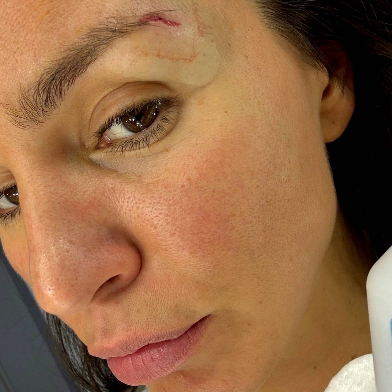 Певица Zivert на фото без макияжа и с седыми волосами показала разбитое лицо