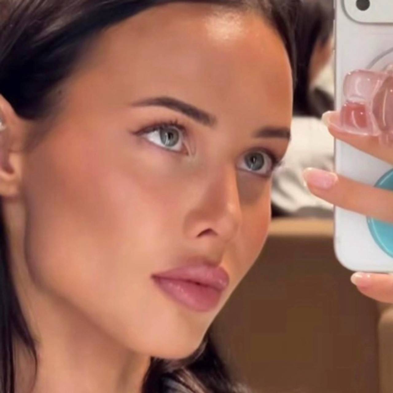 Решетова показала внешность после удаления филлера из губ