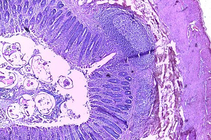 Россиянам объяснили пользу заражения глистами