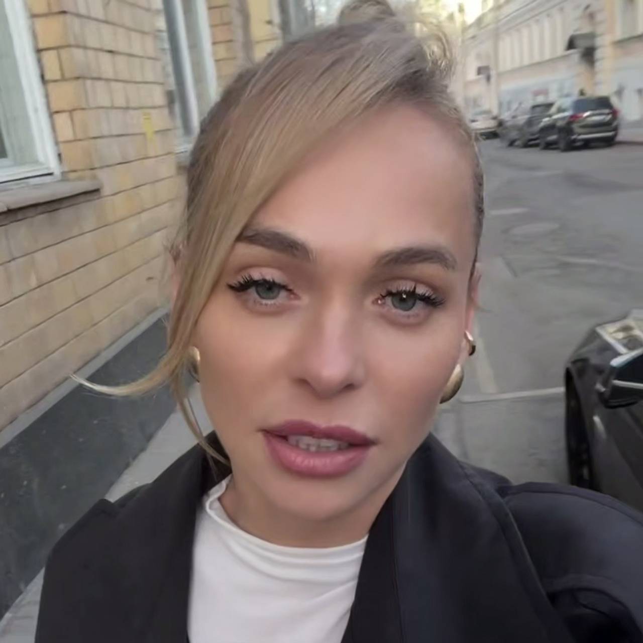 Решившаяся на пластику после третьих родов Хилькевич отменила операцию