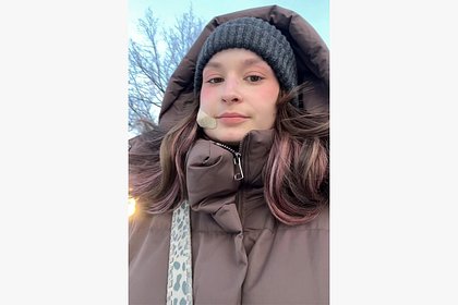 Блогерша выдавила прыщ на лице и едва не лишилась жизни