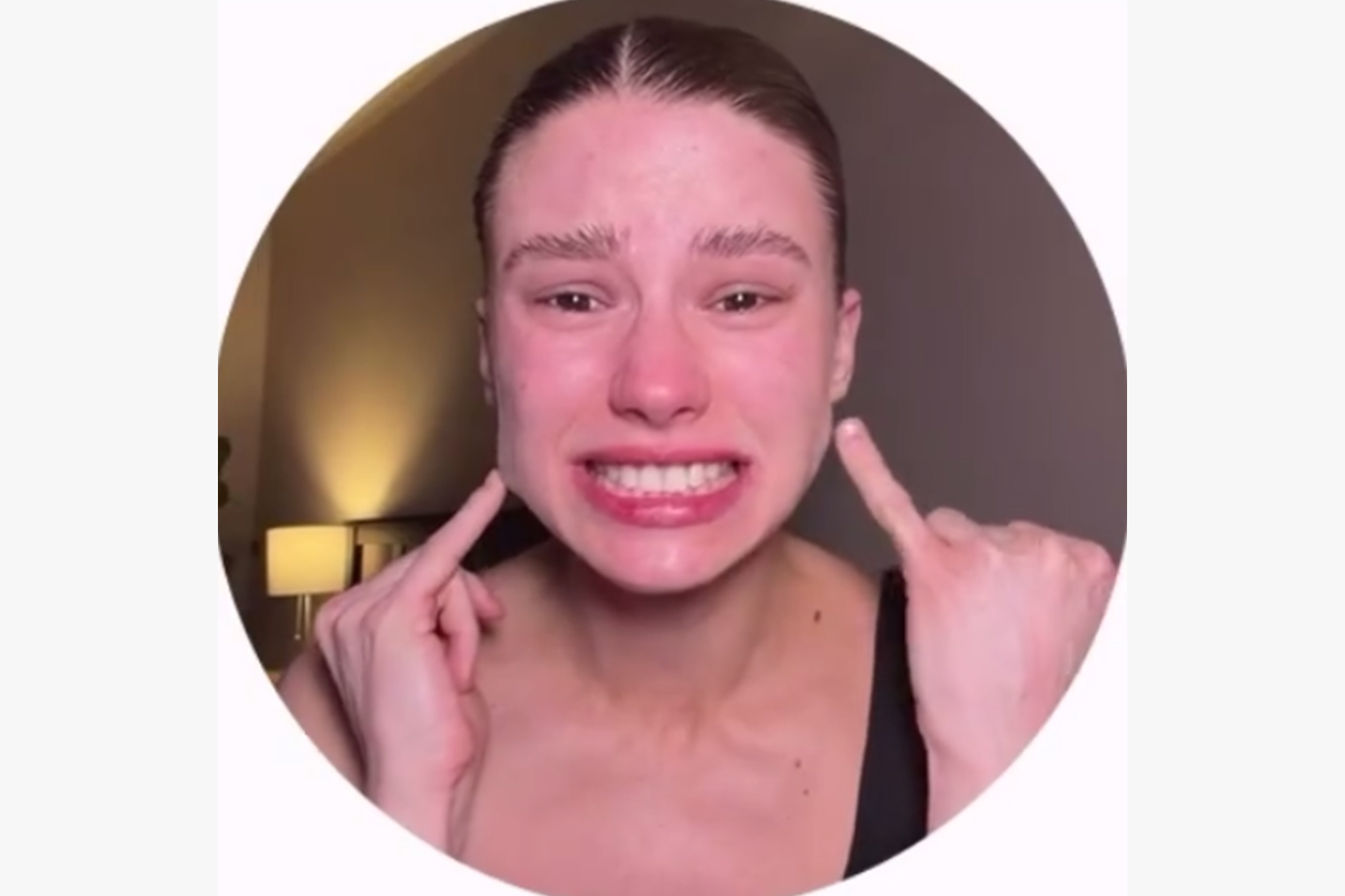 Девушка&nbsp; показала лицо неестественной формы после ботокса