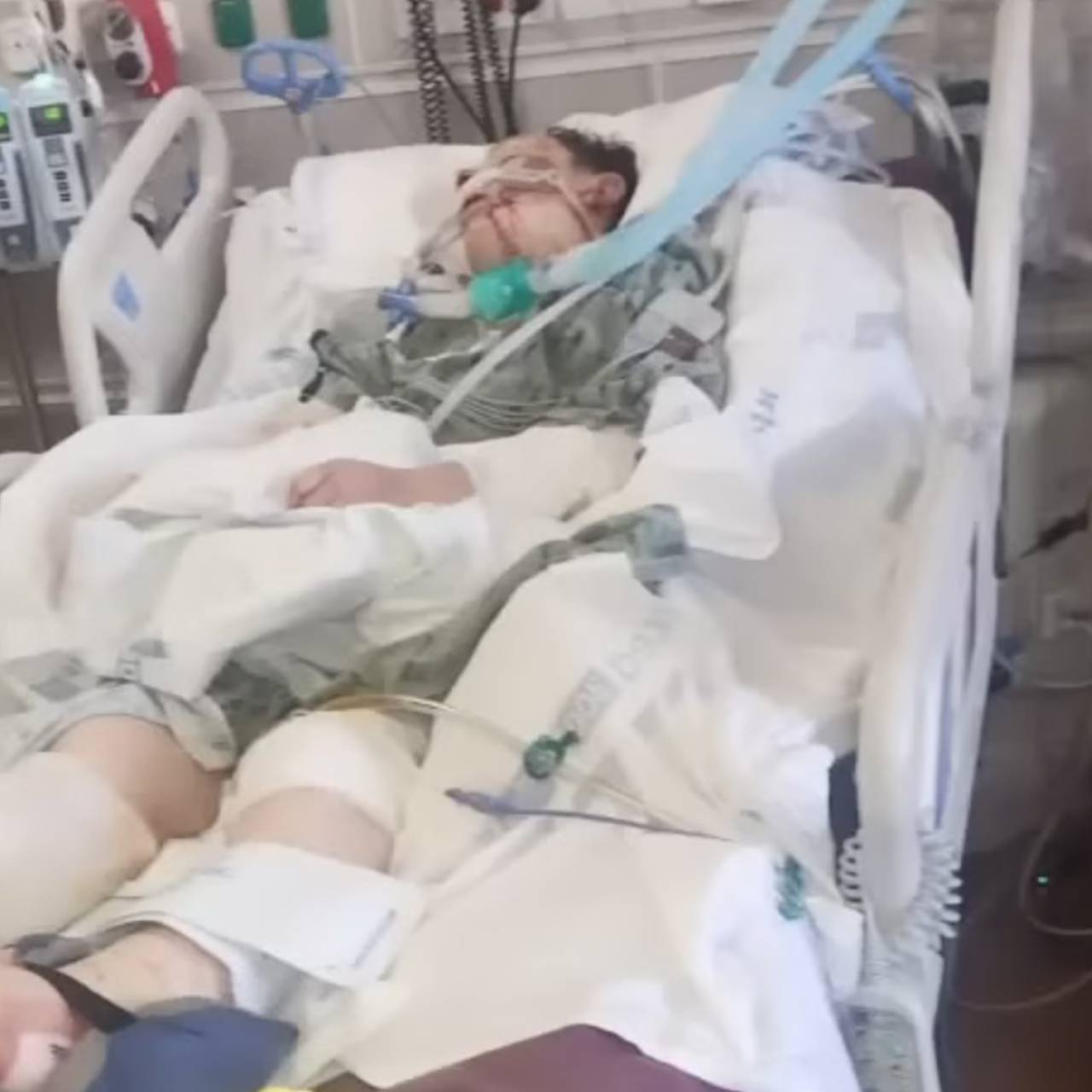 Неизвестный хищник тяжело ранил женщину