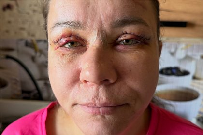 Треш-блогерша Иришка Чики-Пики сделала пластику