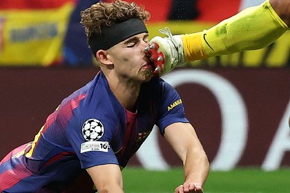 Вратарь &laquo;Атлетико&raquo; разбил ногой лицо футболисту &laquo;Барселоны&raquo; в матче Лиги чемпионов