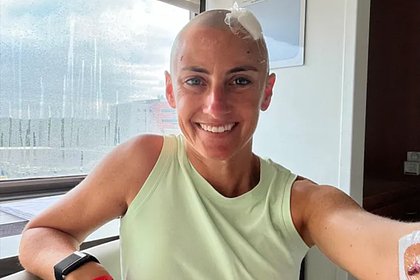 Женщина списала боль в ноге на спортивную травму и оказалась тяжело больна