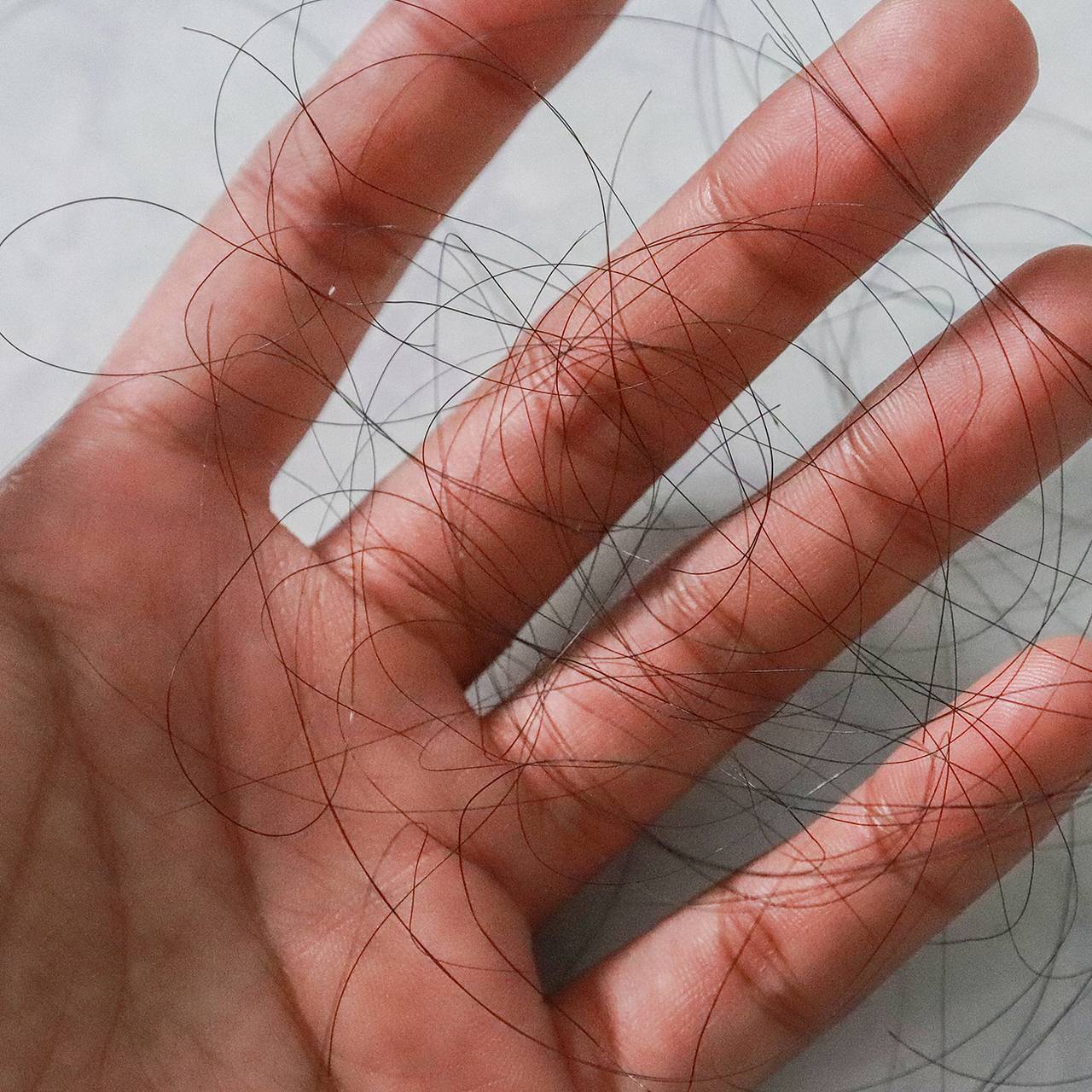 Россиянам раскрыли действенные способы избежать выпадения волос