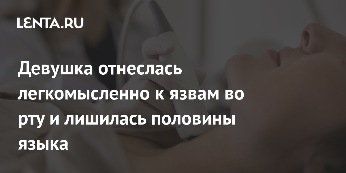 Девушка отнеслась легкомысленно к язвам во рту и лишилась половины языка