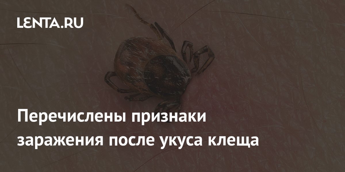 Перечислены признаки заражения после укуса клеща