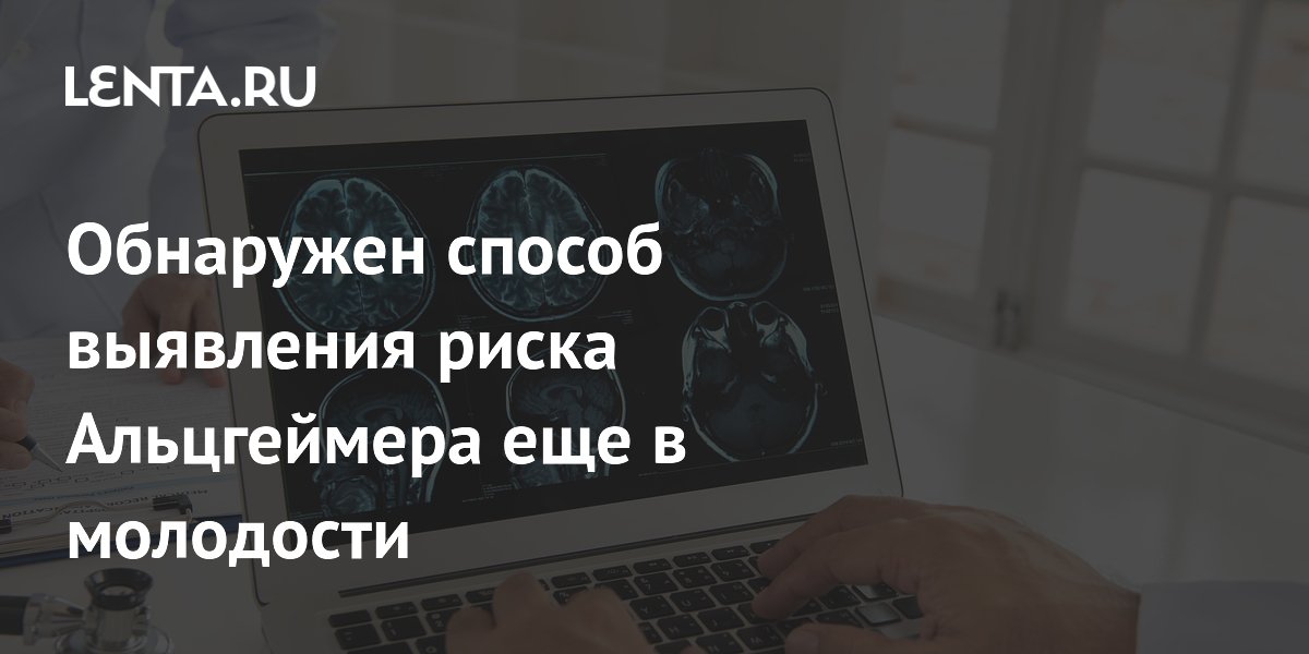 Обнаружен способ выявления риска Альцгеймера еще в молодости