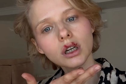 Александра Бортич показала изменившуюся внешность со словами &laquo;не хотела пугать&raquo;