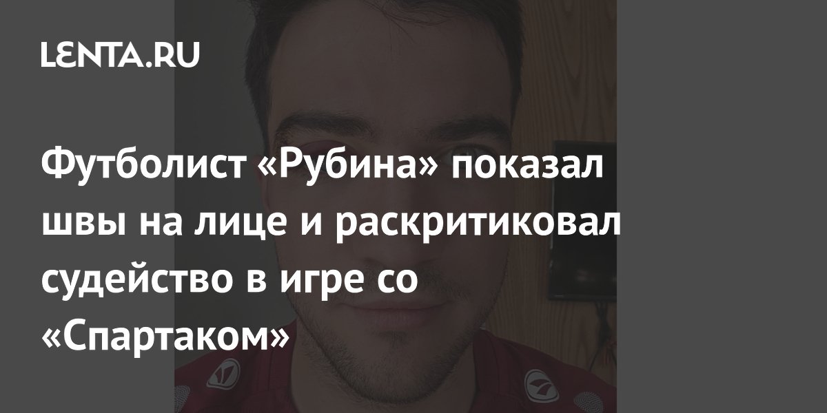 Футболист «Рубина» показал швы на лице и раскритиковал судейство в игре со «Спартаком»