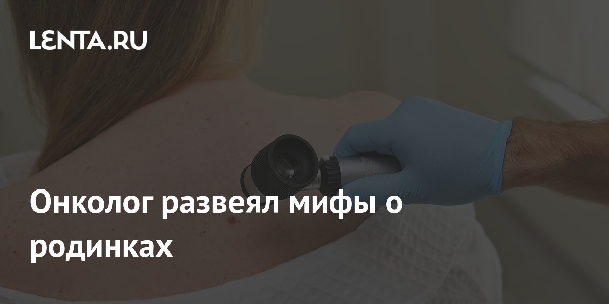 Онколог развеял мифы о родинках