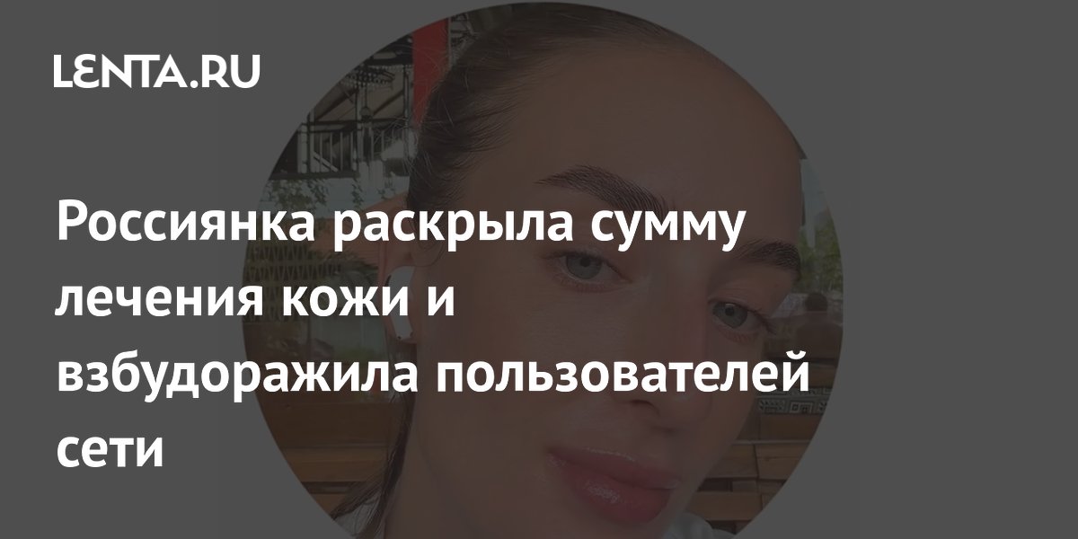 Россиянка раскрыла сумму лечения кожи и взбудоражила пользователей сети