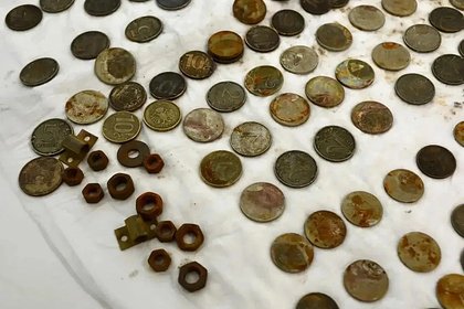 Российские врачи удивились необычной находке в желудке 50-летнего мужчины