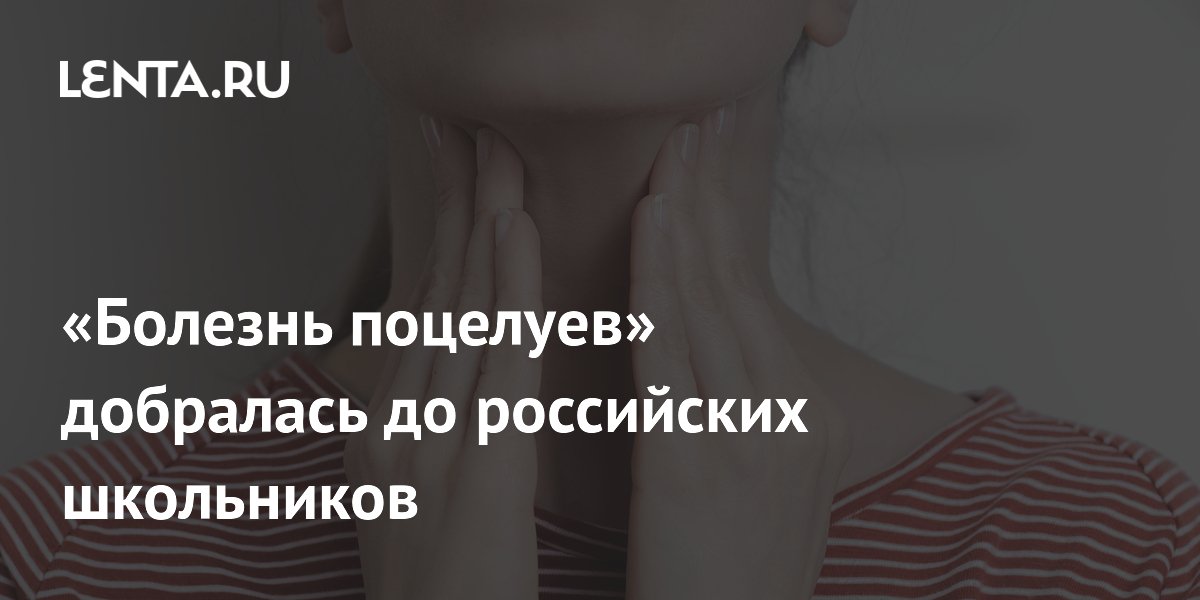 «Болезнь поцелуев» добралась до российских школьников