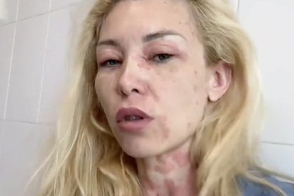 Дочь легендарного дрессировщика попала в реанимацию во время отпуска