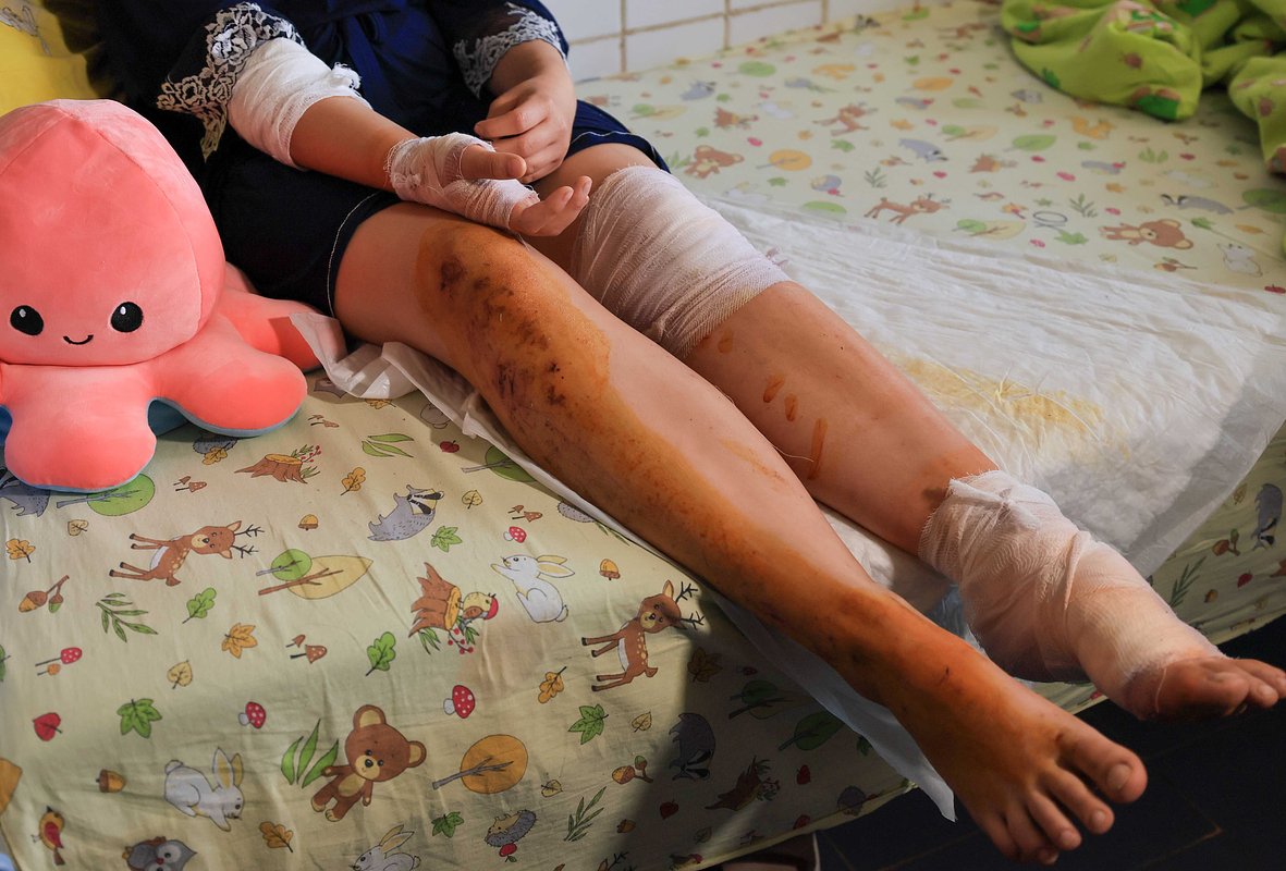 15-летняя Мария Мысник, раненная во время атаки на общежитие в Старобельске, в операционном отделении Луганской детской клинической больницы, 23 мая 2026 года
