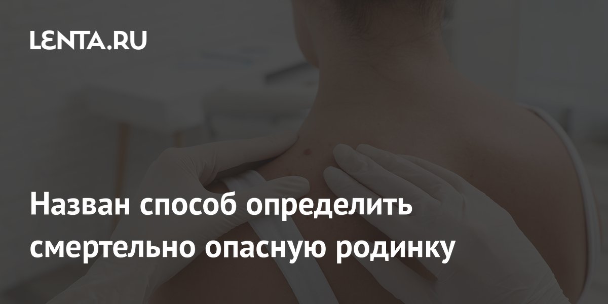 Назван способ определить смертельно опасную родинку