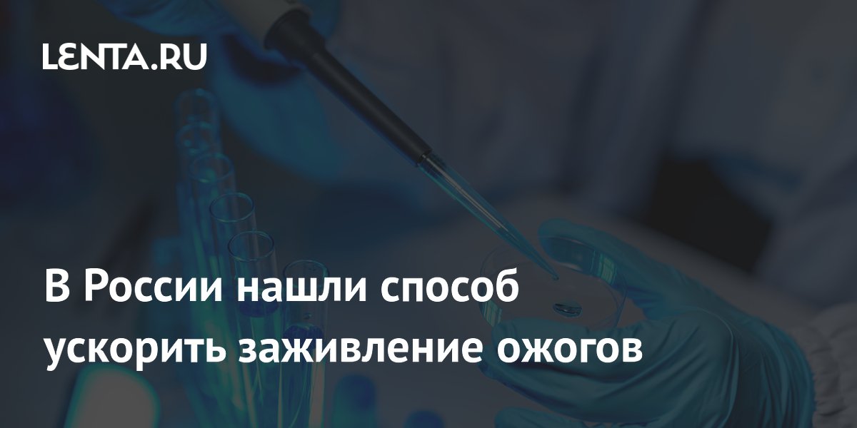 В России нашли способ ускорить заживление ожогов