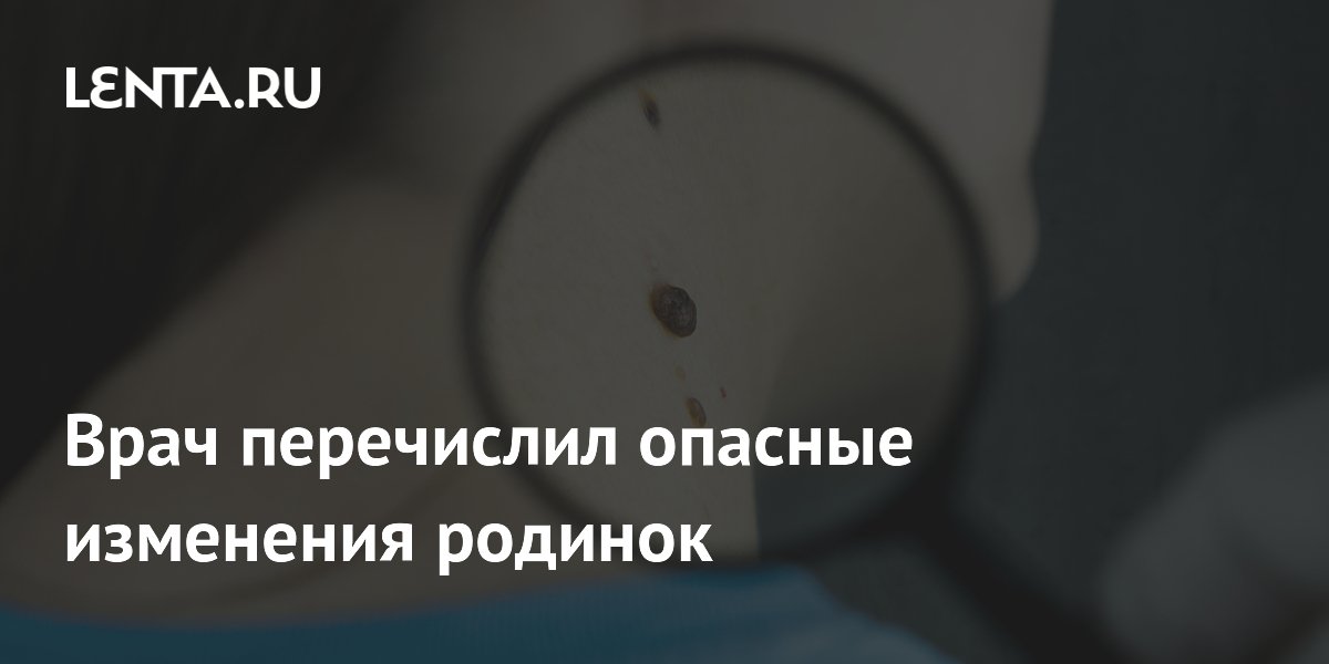 Врач перечислил опасные изменения родинок